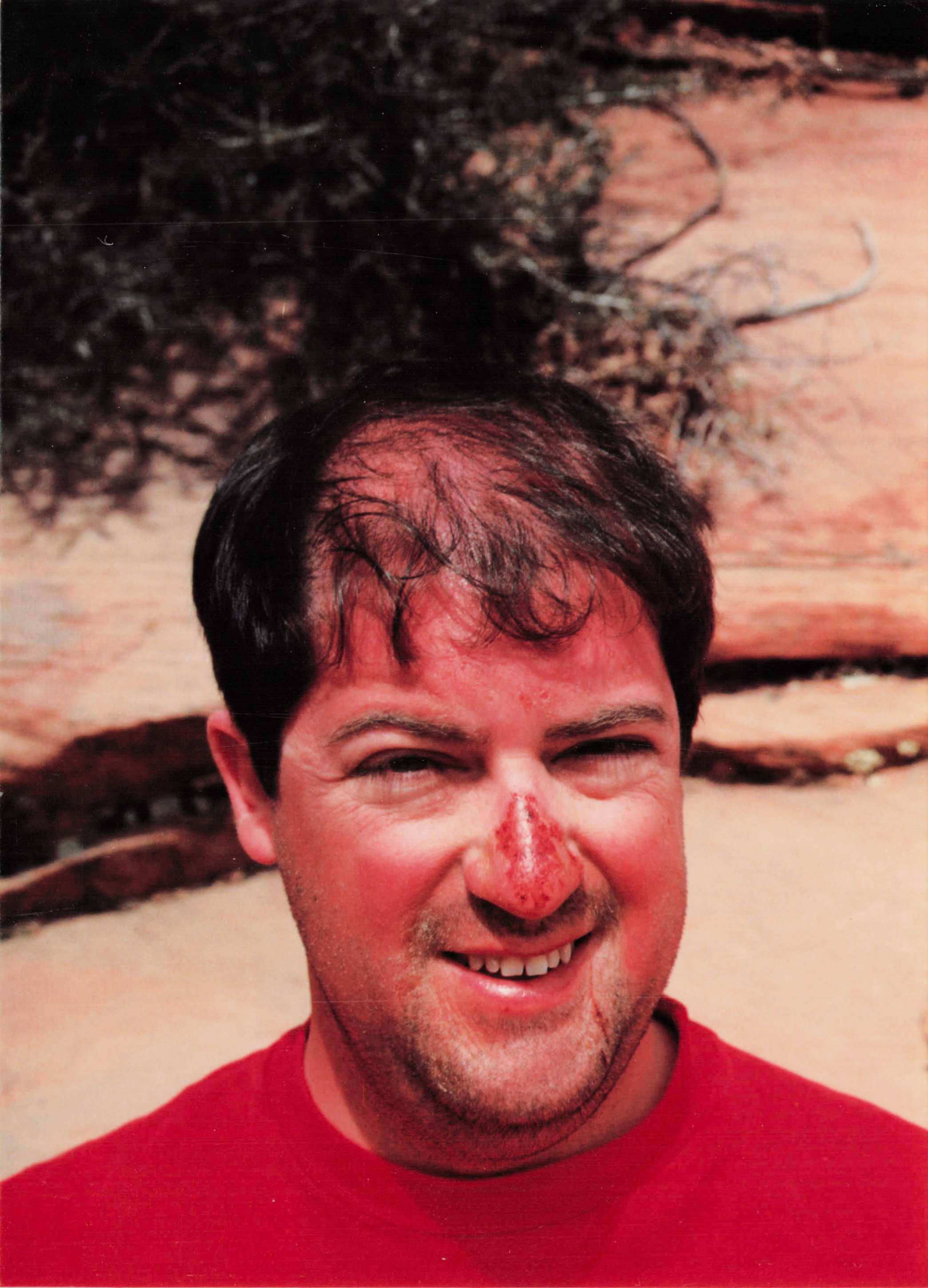Zion National Park on the ski trip — red sandstone, sunburned nose